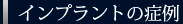 インプラントの症例