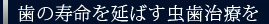 歯の寿命を延ばす虫歯治療を