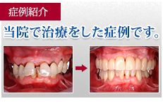 症例紹介当院で治療をした症例です。